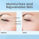 Hydrate & Replenish Hydra Eye Cream - SkinLab